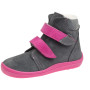 gris/rosa